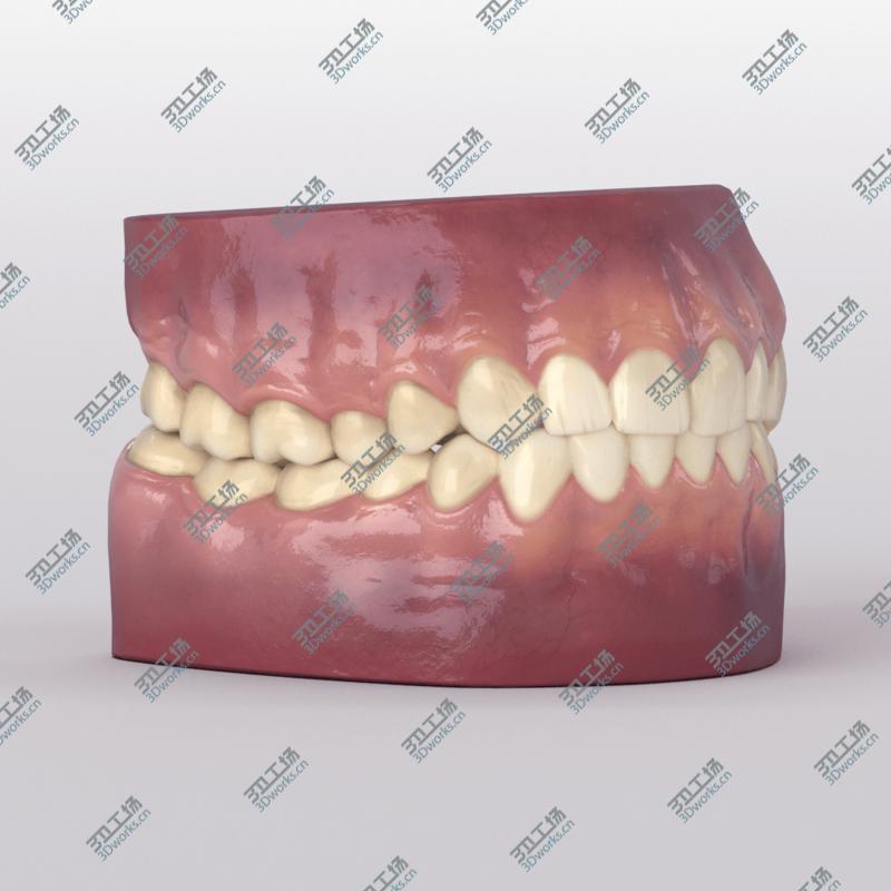 images/goods_img/202104092/Teeth With Roots And Gums 3D model/4.jpg